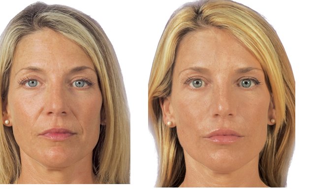 Photo of Botox Clinic