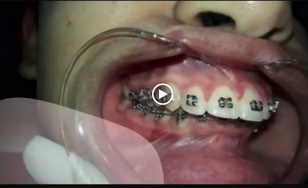 Foto de 🦷pro-dental Esthetic (odontología General y Especializada/ Tratamientos Faciales y Corporales)