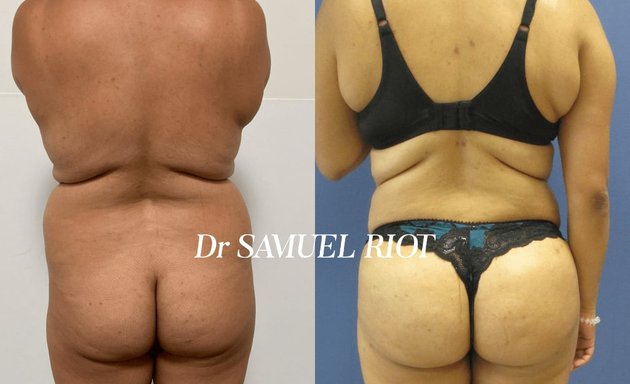 Photo de Dr Samuel RIOT - Chirurgie et Médecine Esthétique Toulouse - EMSCULPT® - EMTONE®