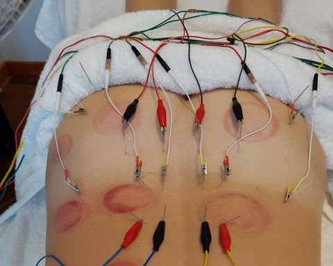 Photo of Rejuvenate Acupuncture