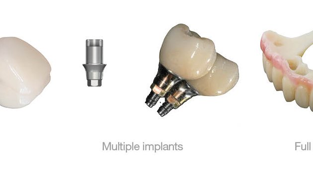 Photo of Megagen Implants UK