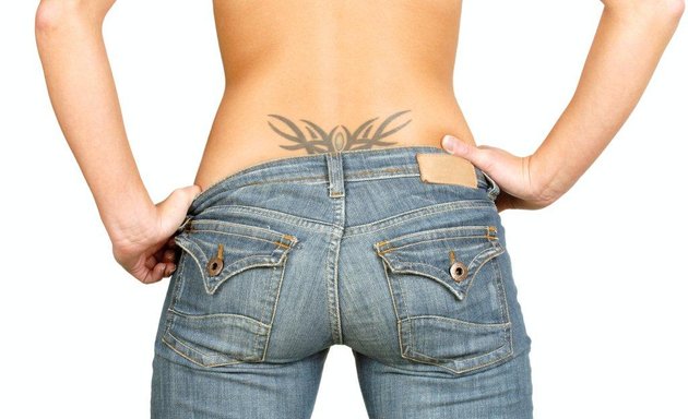 Photo of FADE FAST Laser Tattoo Removal