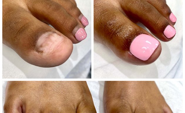 Photo of Nails by Toe Bro