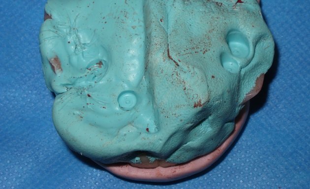 Photo of Maxillofacial Prosthodontics UK