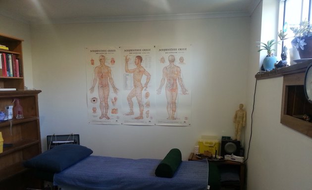 Photo of Essential Wellbeing Acupuncture