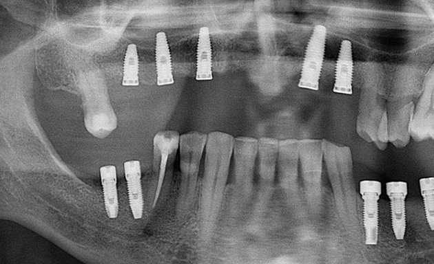 Foto de RADIO TOOTH Imágenes Dentales Radiografías Panorámica