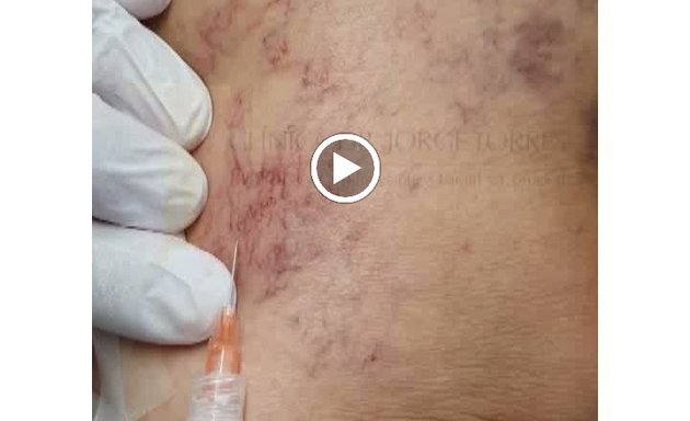 Foto de Clínica Dr. Jorge Torres | Medicina y Cirugía Estética Facial y Corporal