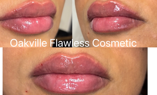 Photo of Oakville Flawless Cosmetic| Botox • Fillers • ThreadLift Clinic