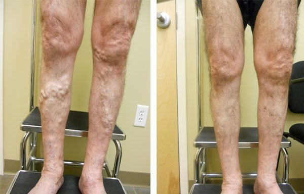 Photo of Vein Specialists of Tampa