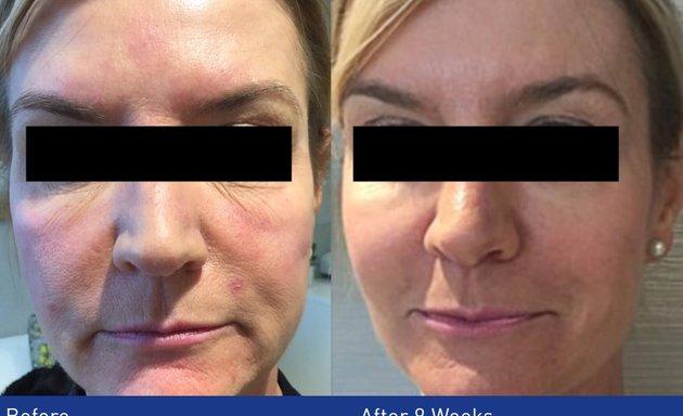 Photo of Face Perfect Clinic