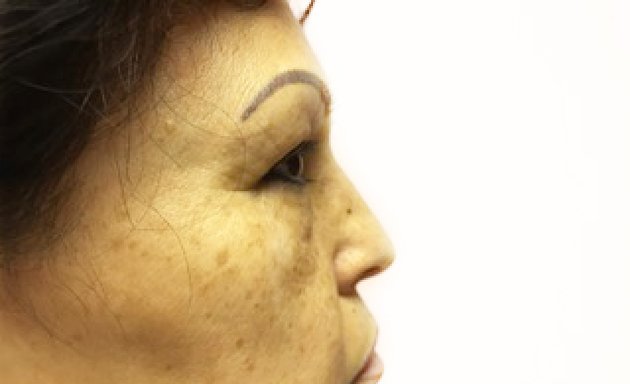 Photo of 63rd Laser & Skin Clinic - Chicago’s Affordable Plastic Surgery