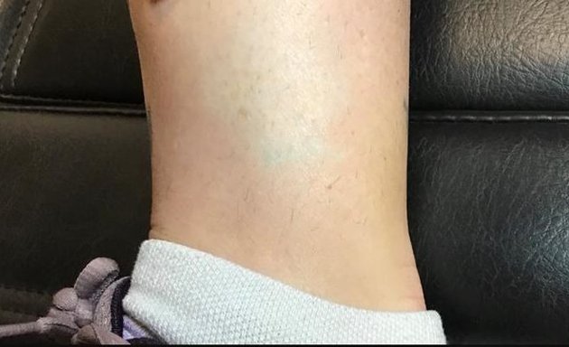 Photo of Removery Tattoo Removal & Fading