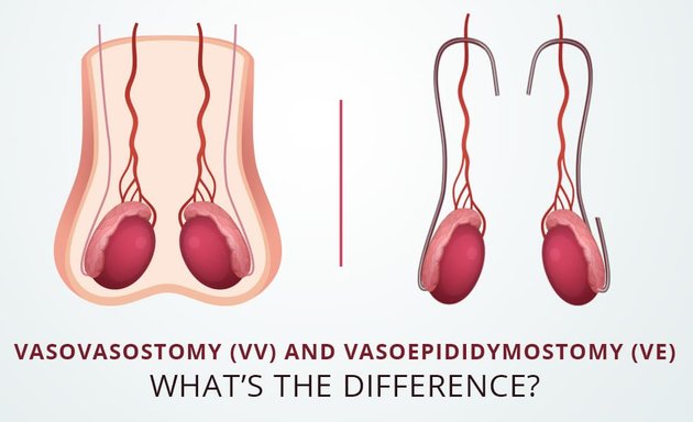 Photo of Dr. Weiss & Dr. Bercier Vasectomy, Circumcision And Vasovasostomy