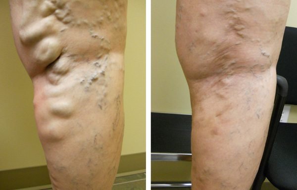 Photo of Vein Specialists of Tampa