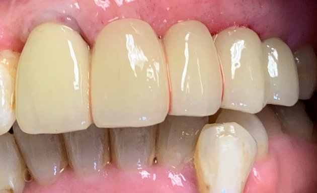 Photo of Apex Dental