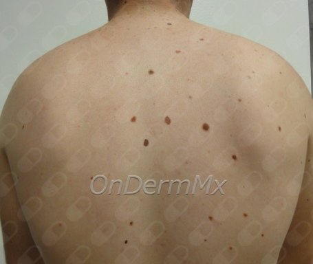 Foto de Dr. Roger Adrián González Ramírez, Dermatólogo