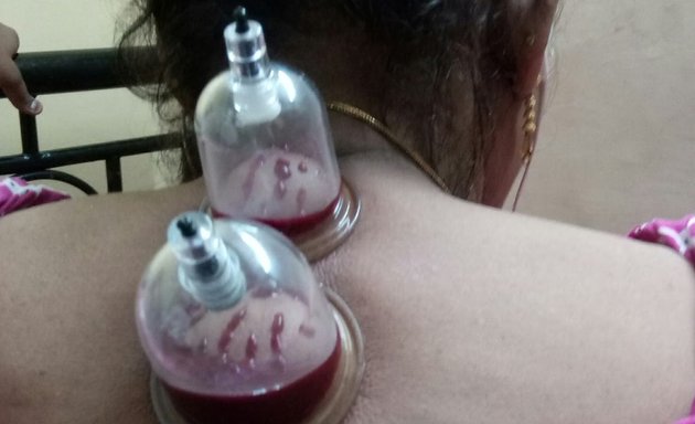 Photo of Derma Care Cupping
