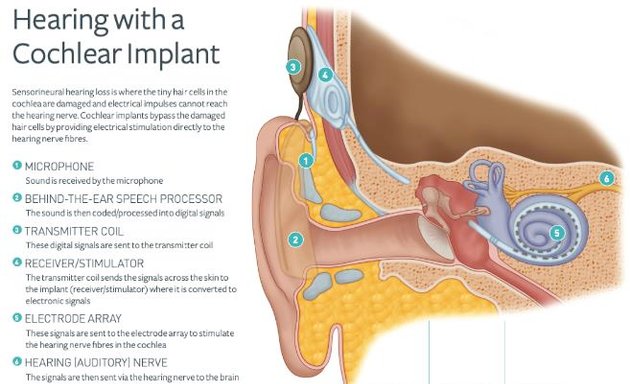 Photo of University of Southampton Auditory Implant Service