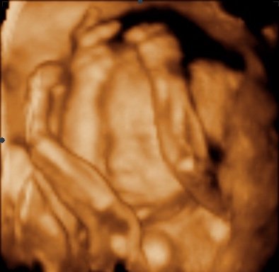 Photo of UC Baby 3D Ultrasound
