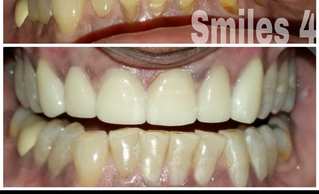 Photo of Smiles 4 U speciality dental implant centre/Dr Milin D Desai