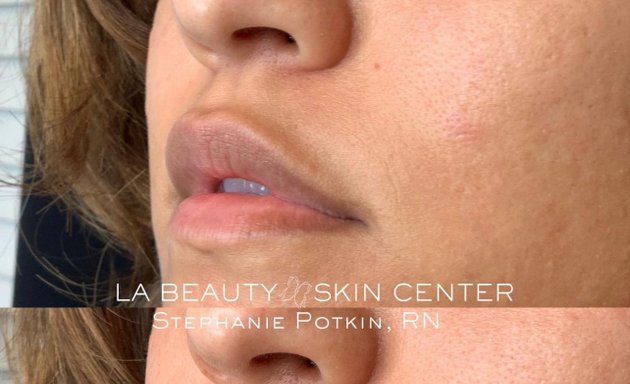 Photo of LA Beauty Skin Center