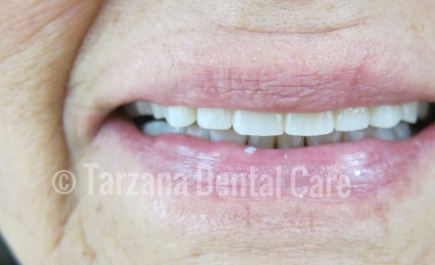 Photo of Tarzana Dental Care