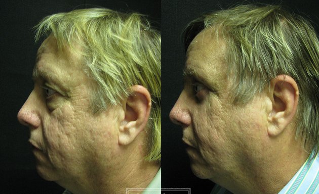 Photo of Salvatore J. Pacella, M.D. Cosmetic & Plastic Surgery