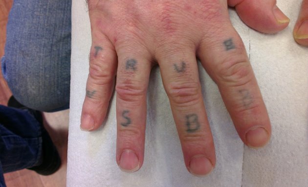 Photo of Oxford Tattoo Removal