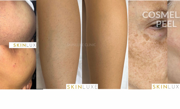 Photo of Skinluxe Clinic