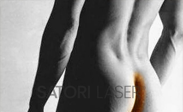 Photo of Satori Laser