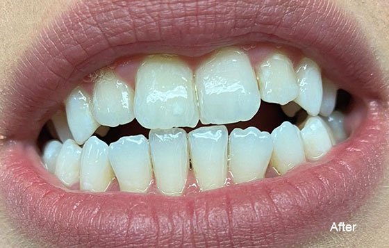Photo of London Teeth Whitening