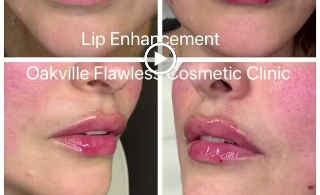 Photo of Oakville Flawless Cosmetic| Botox • Fillers • ThreadLift Clinic