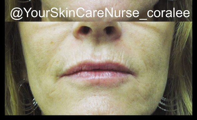 Photo of Your SkinCare Nurse