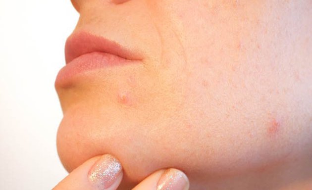 Photo of Skin Nutritious • holistic acne clinic