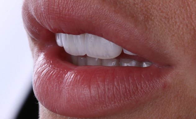 Foto de GLOSS DENT ® Chile – Odontología Estética