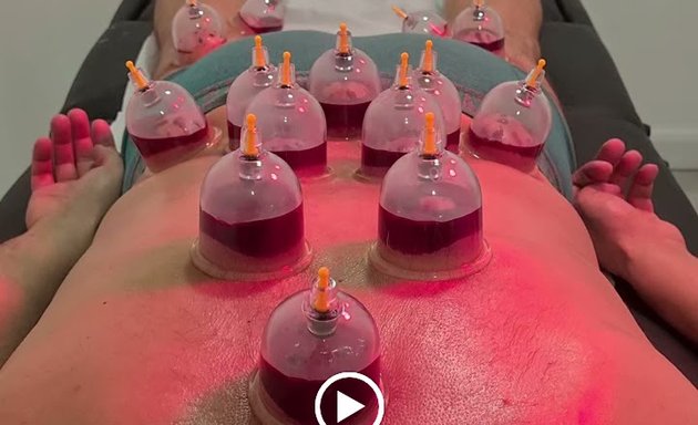 Photo of Cupping Clinic | Hijama | Cupping | Massage