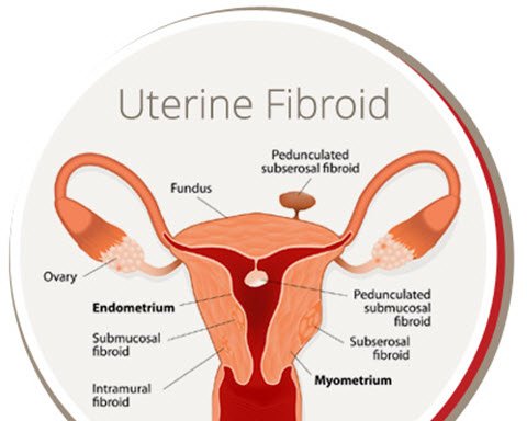 Photo of USA Fibroid Centers