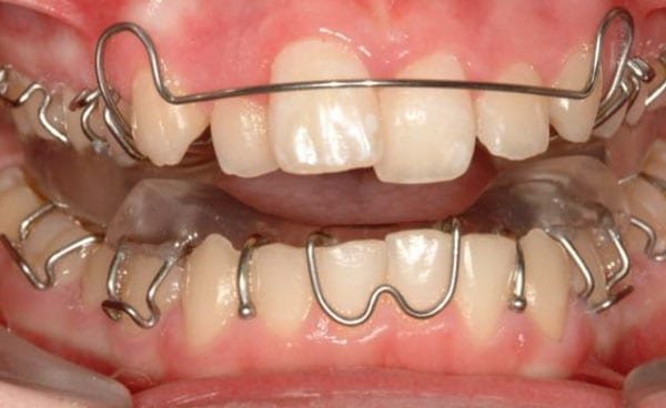 Photo of Dentists at Coorparoo - Coorparoo Dentists