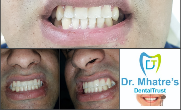 Photo of Dental Trust - Dentist In GORAI BORIVALI -Dr.NEELAM MHATRE'