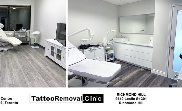 Photo of Tattoo Removal Clinic | Brampton