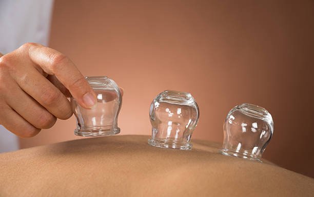 Photo of Safrozs Cupping Therapy