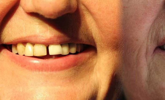Photo of Shergill Dental Implants