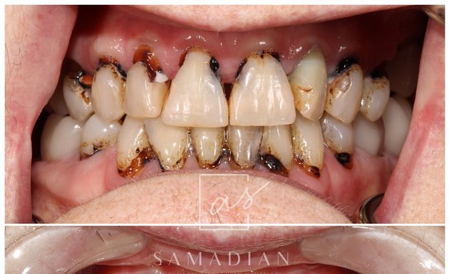 Photo of Dr. Amin Samadian Cosmetic & Advanced Dentistry