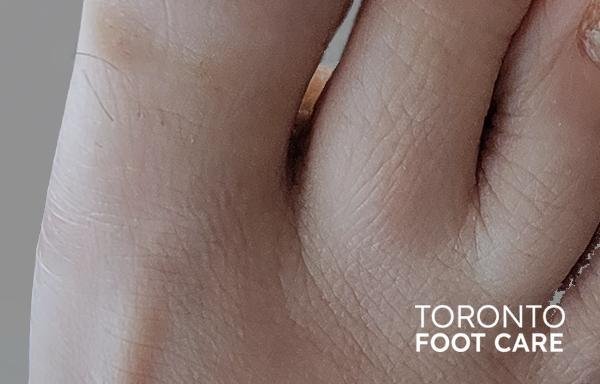 Photo of Toronto Foot Care