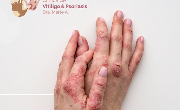 Foto de Clínica de Vitiligo y Psoriasis Dra. Marte