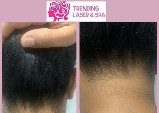 Photo of Trending Laser & Spa