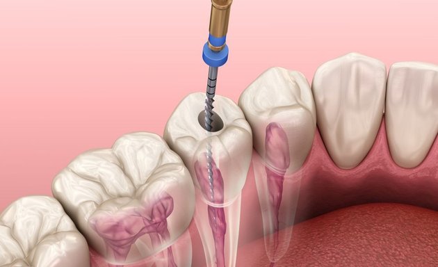 Photo of Arvind's Advanced Dental Care (Root Canal Treatment, Orthodontics, Implant Centre)