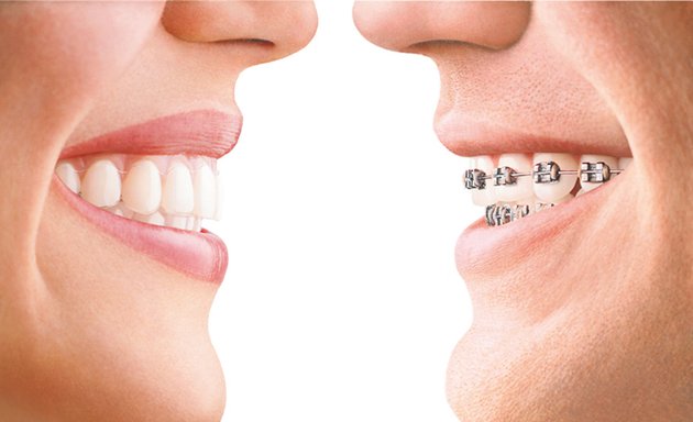 Photo of Teeth in Line Orthodontics