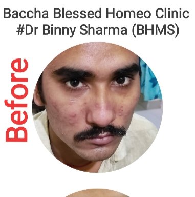 Photo of Baccha blessed homeo clinic #Dr Binny Sharma (BHMS)