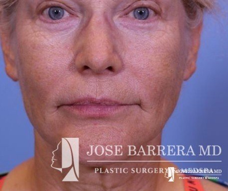 Photo of Jose Barrera, MD, Facial Plastic and Reconstructive Surgeon